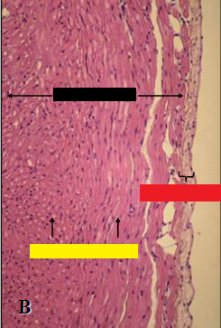 It is the bulk of the ventricular wall and is composed of cardiac muscle (Black)