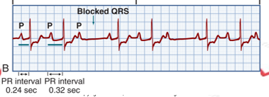PR length increasing 