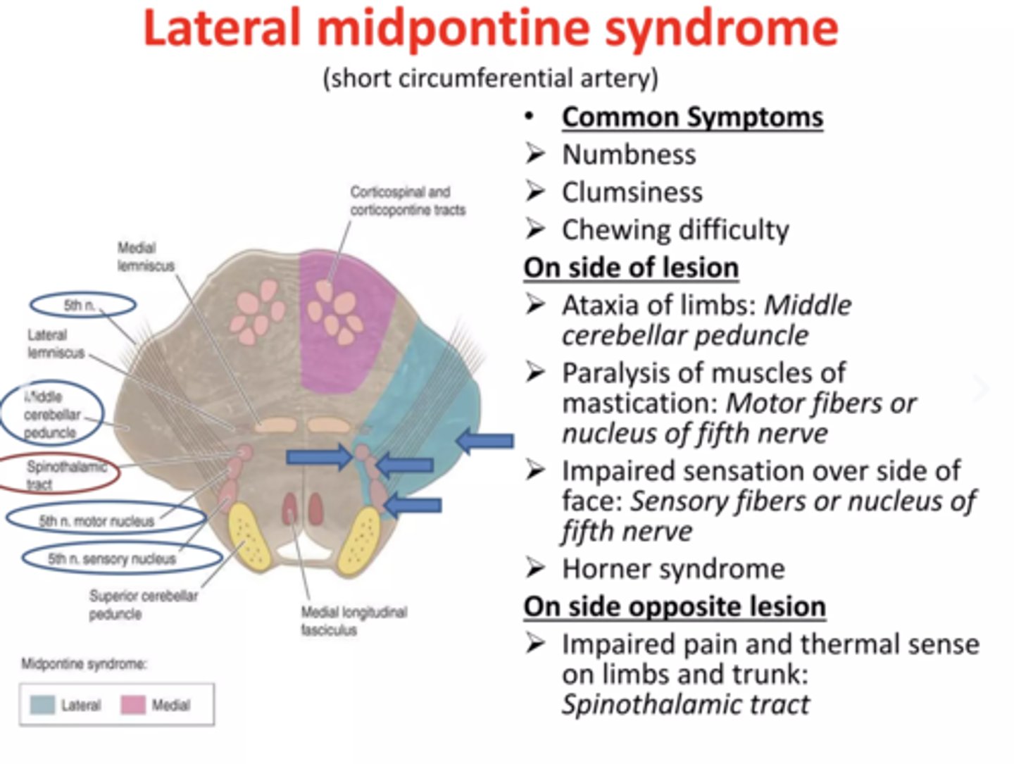 <p>Ipsilateral</p><p>▫ Ataxia of limbs</p><p>▫ Paralysis of mastication</p><p>▫ Impaired sensation over side of face</p><p>Contralateral</p><p>▫ Paralysis of FACE, UE &amp; LE</p>