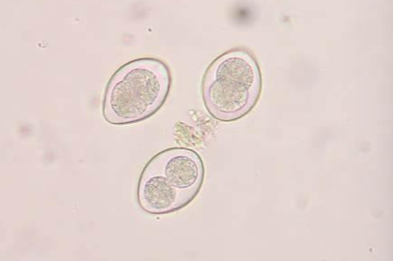 <ul><li><p>symptoms: diarrhea, weight loss, poor growth </p></li><li><p>diagnosis: fecal smears </p></li><li><p>treatment: treat only if a high oocyst count is identified on fecal examination or if diarrhea is present </p></li><li><p>treatment options </p><ul><li><p>amprolium </p></li><li><p>sulfadimethoxine </p></li><li><p>ponazuril </p></li><li><p><strong>Decoquinate (added to feed to reduce oocyst production) </strong></p></li></ul></li><li><p>preventive measures </p><ul><li><p>daily cleaning: scrape pens and remove soiled or wet bedding every day </p></li></ul></li></ul><p></p>