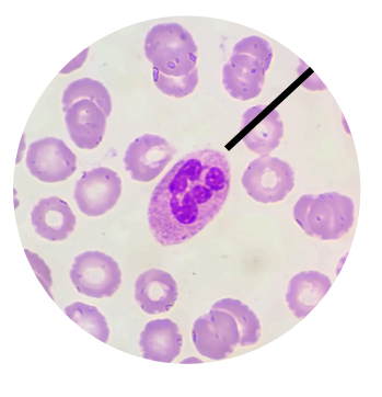 <p>what kind of white blood cells is this?</p>