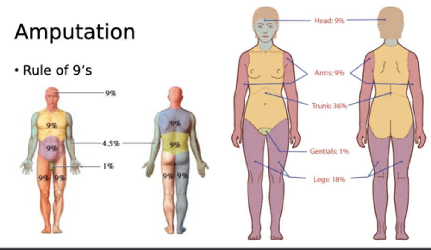 <p>Rule of 9's</p><p>(4.5% in each arm)</p>