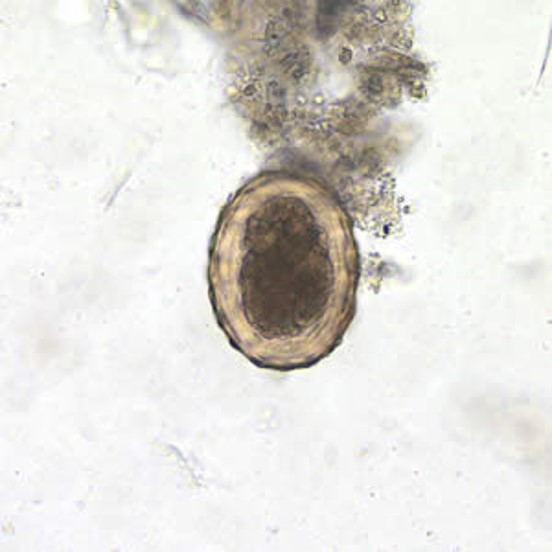 What is this egg