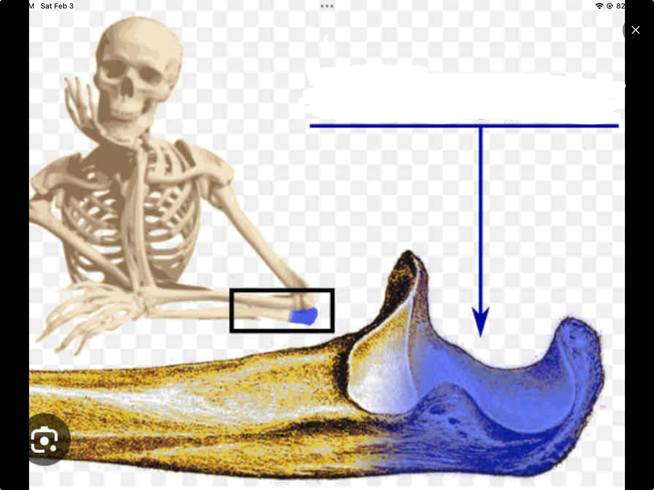 <p><span>The posterior of the elbow</span></p>