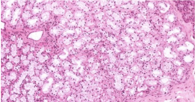 <ul><li><p>Acinos mixtos (predominio mucoso)</p></li><li><p>Conductos intralobulillares y excretores y pocos intercalares</p></li><li><p>Contiene semmilunas de Von Ebner</p></li><li><p>Se tiñen mal porque el moco es una estructura rica en carbohidratos que no atrae hematoxilina ni eosina</p></li></ul><p></p>