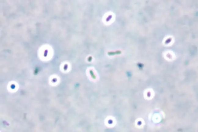 <ul><li><p>capsules may be colorless against a stained background</p></li><li><p>may be indicative of virulent</p></li><li><p>capsule: most external layer of bacteria</p></li><li><p>negative staining</p></li></ul>