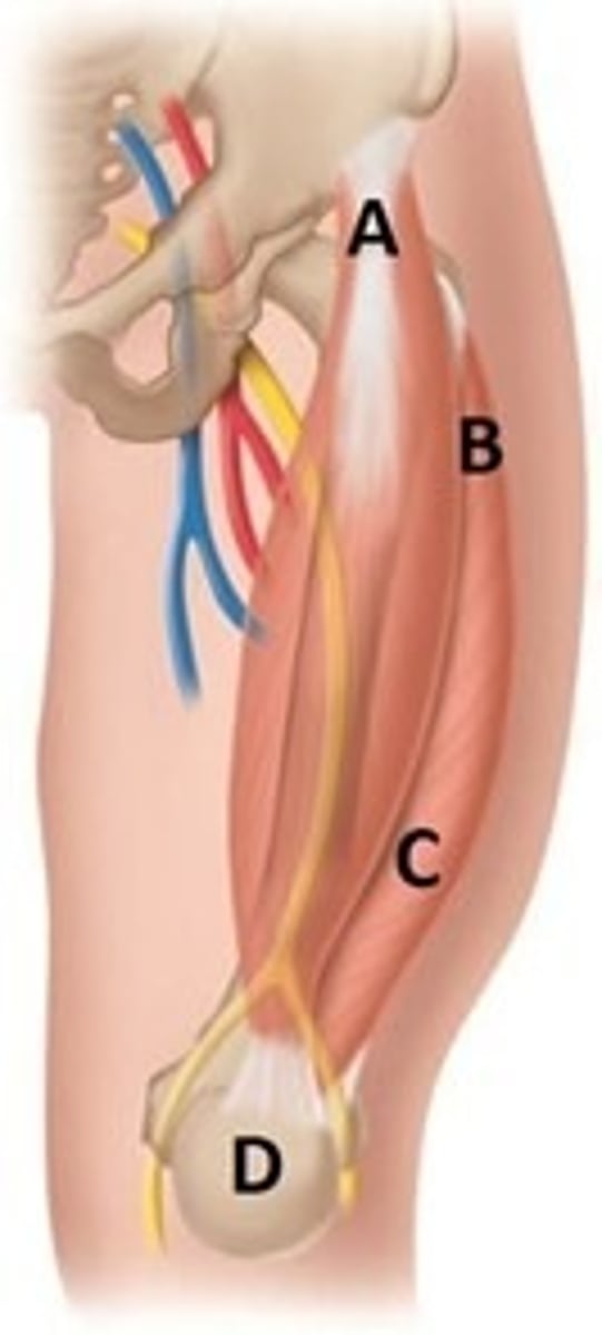 <p>35) The nurse is preparing to provide a newborn with a prescribed intramuscular injection. Which area should the nurse use for this injection?</p><p>A) A</p><p>B) B</p><p>C) C</p><p>D) D</p>