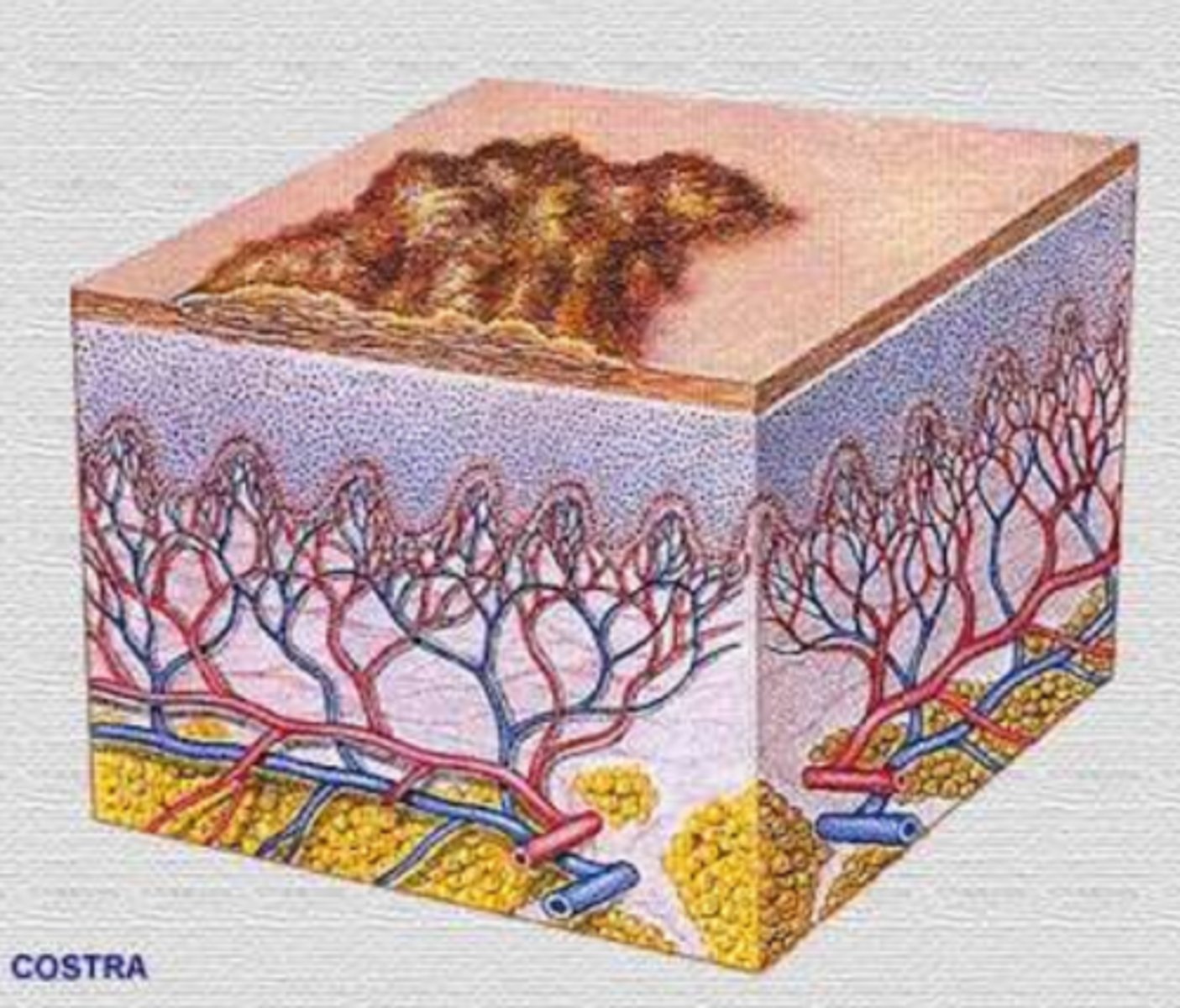 <p>¿lesión?</p><p>¿primaria o secundaria?</p>