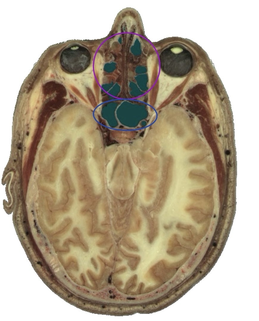 <p>What structure is labeled circled in purple?</p>