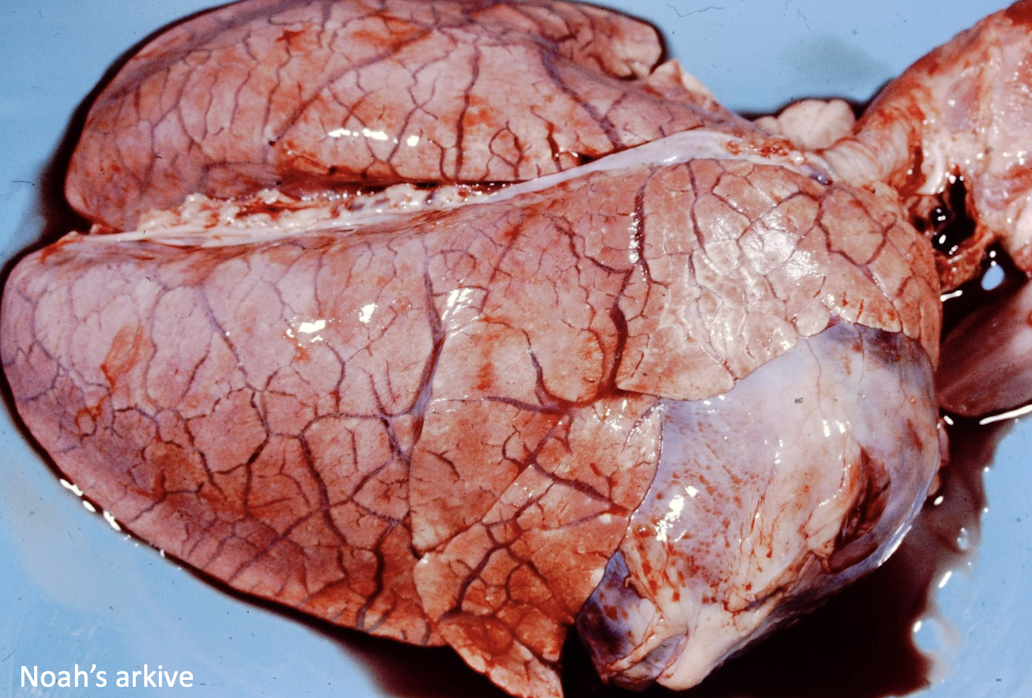 <p>This is associated with what clinical syndrome?</p>