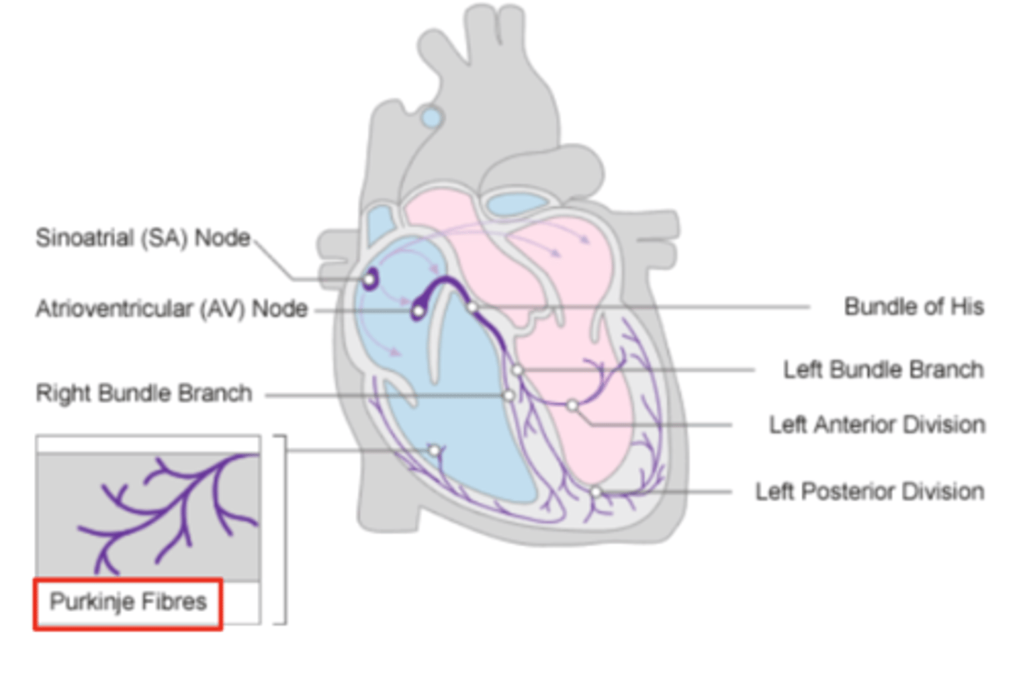 <p>specialized conductive fibers in the walls of the ventricles that </p><p>facilitate rapid transmission of electrical impulses, </p><p>ensuring efficient and synchronized ventricular contraction.</p>