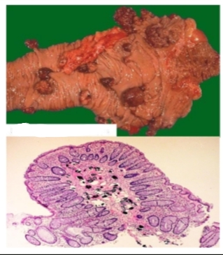 <p>Identify then Describe the macroscopic and microscopic features </p>