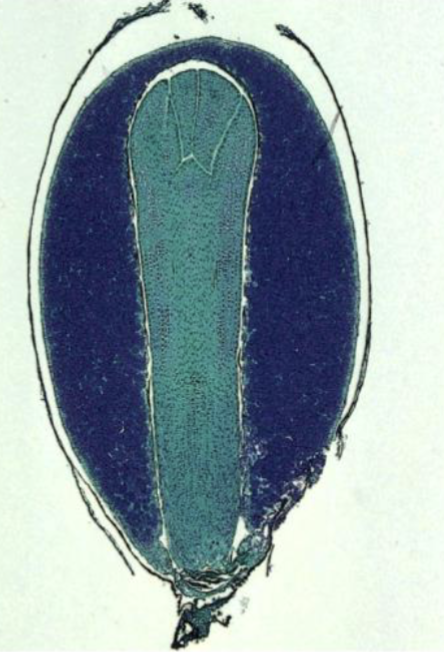<p>Which structure is being shown?</p>