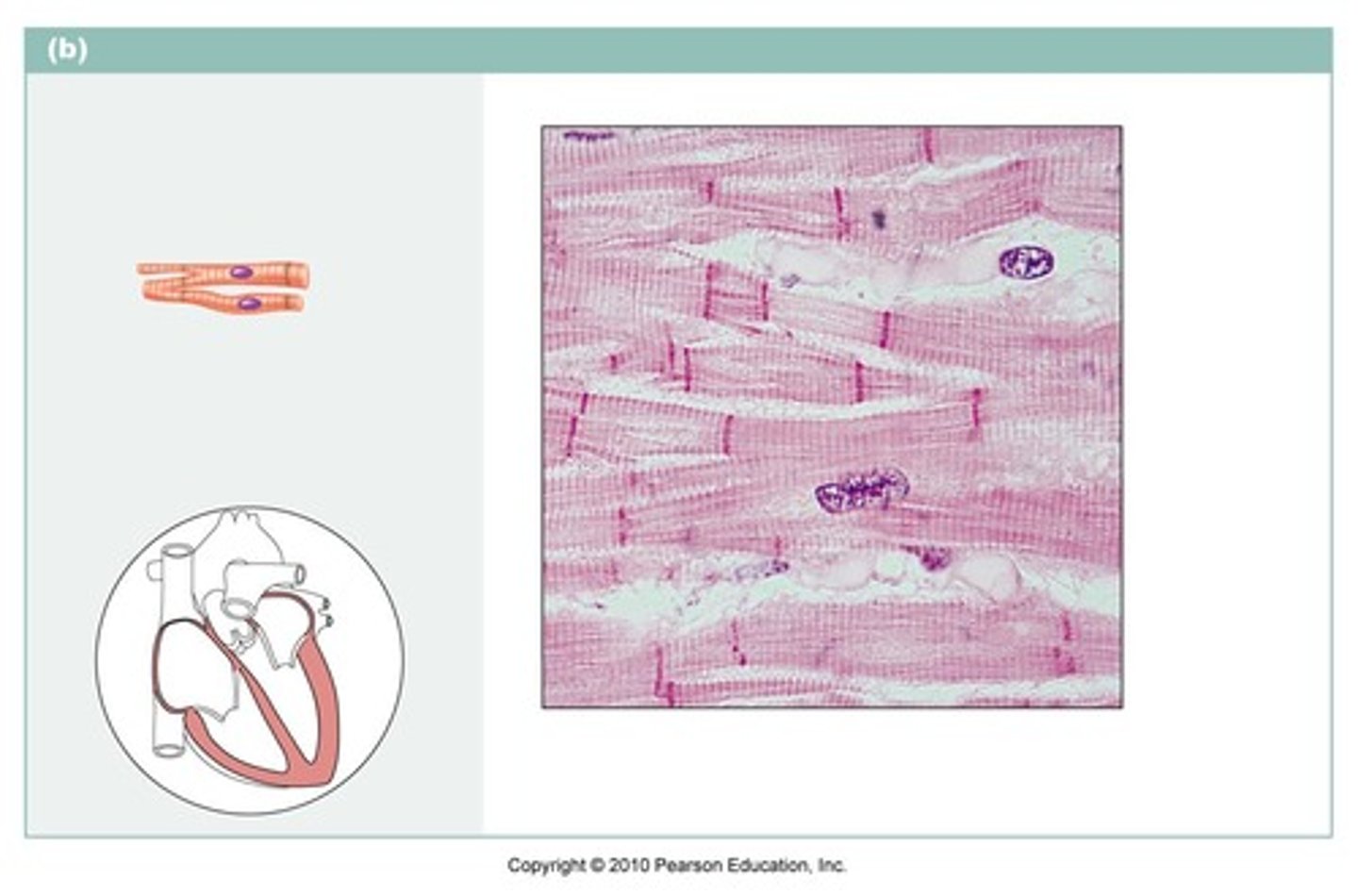 <p>Branched (Y-shape) and shorter than skeletal fiber cells, striated, found in wall of the heart. Involuntary muscle control</p>