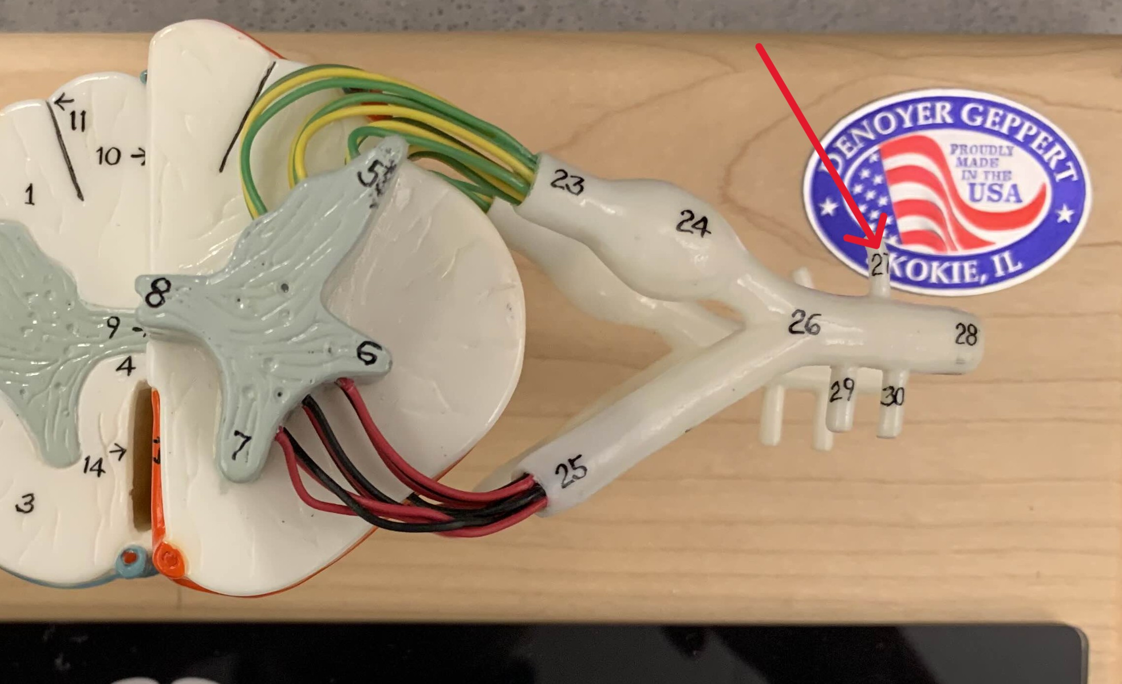 <p>Which ramus of the spinal cord is:</p><ul><li><p>Posterior to ventral ramus</p></li></ul><p></p>