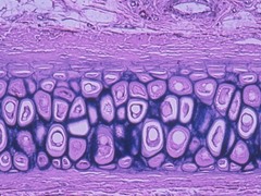 <h2><span class="heading-content">elastic stains very dark purple but reveals very big cells</span></h2><p>• Functions = Maintains shape of structure, allows great flexibility • Locations = Supports external ear, epiglottis</p>