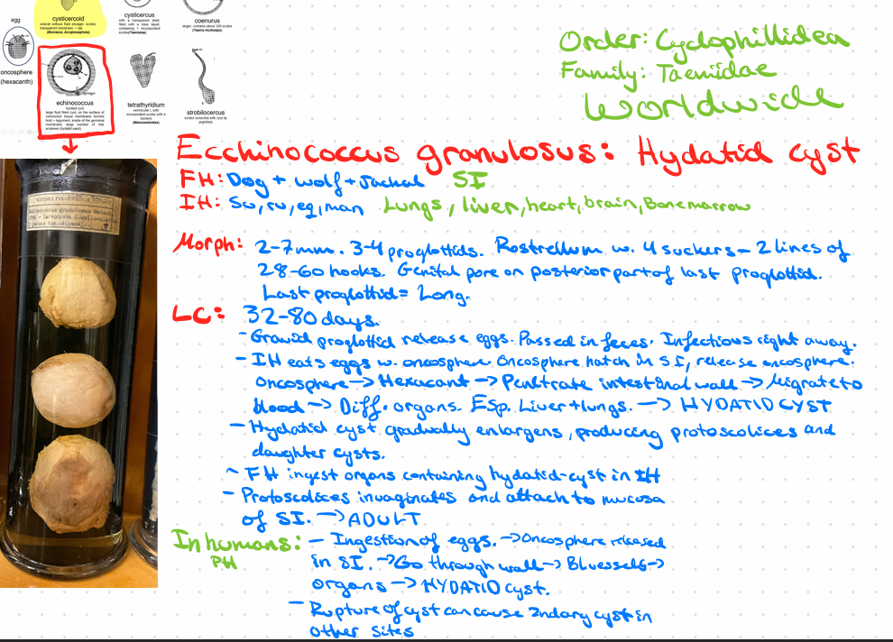 <p>Echinococcus granulosus - Hydatid cyst</p>