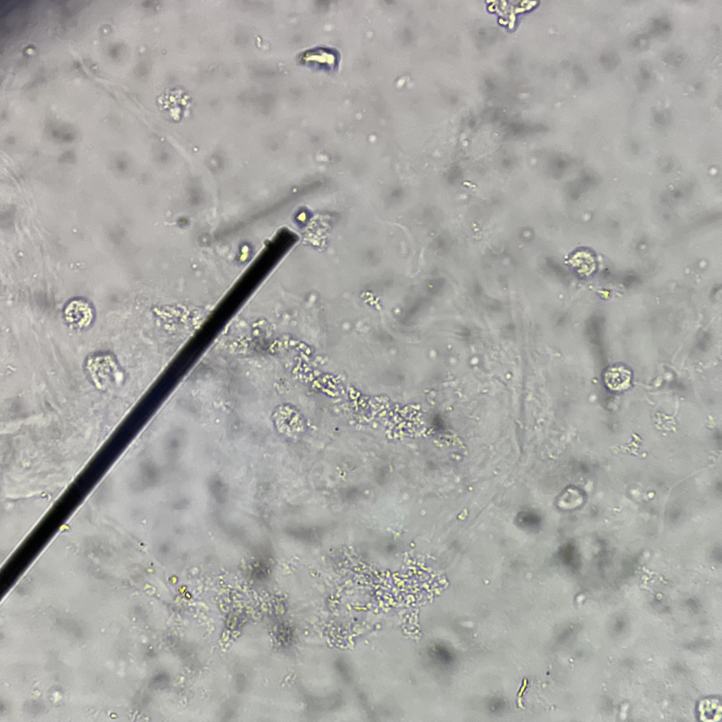 <ol><li><p>Identify pointed structure.</p></li><li><p>What type of content is high in foods where this crystal is found?</p></li></ol><p></p>
