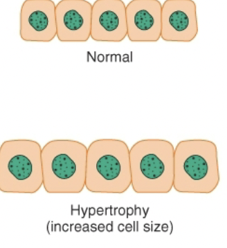 <p>Hypertrophy </p>