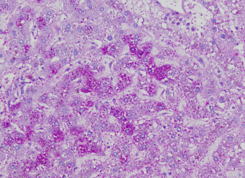 <p>Special stain for glycogen storage </p>