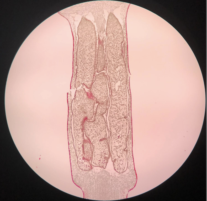 <p>Spore capsule</p><p>Where haploid spores are produced. </p><p>This image is a polytrichum </p>