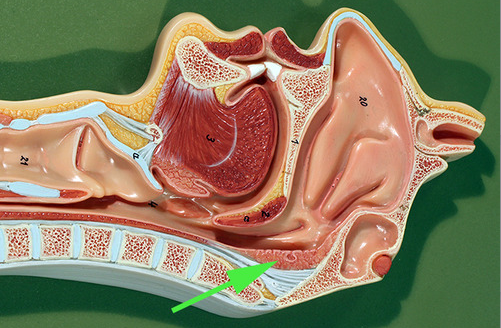 <p><span>The structure indicated by the green arrow is the</span><br><span><strong>pharyngeal</strong> tonsil</span></p>