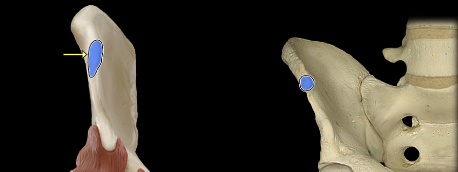 <p>Anterior superior iliac spine</p>