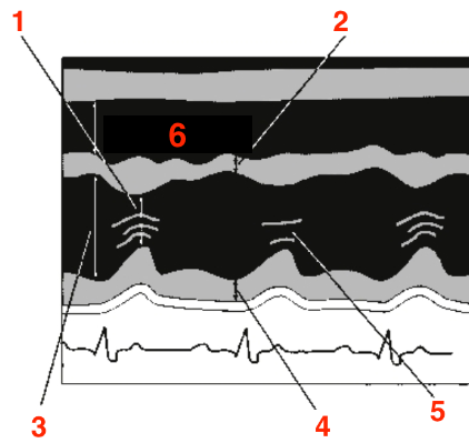 <p>Identify this image. </p>