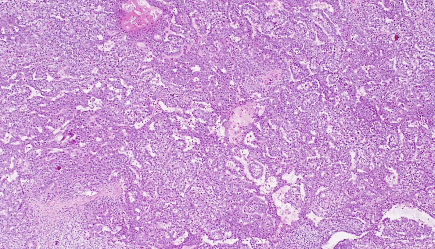 term image