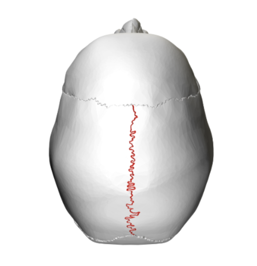 <p>what is this skull feature? </p>