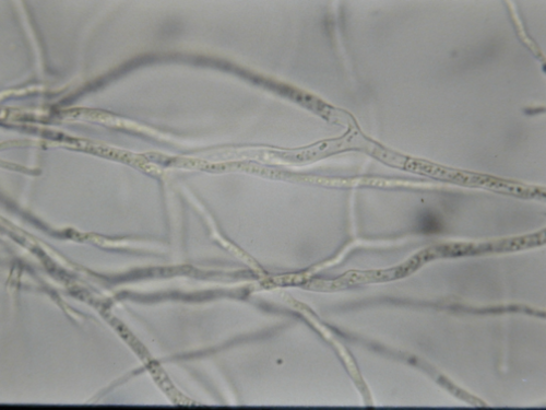 <ul><li><p>y-branching</p></li><li><p>No spores</p></li><li><p>No cross walls</p></li></ul><p></p>