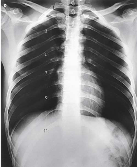 <p>What projection, position and anatomy is this?</p>