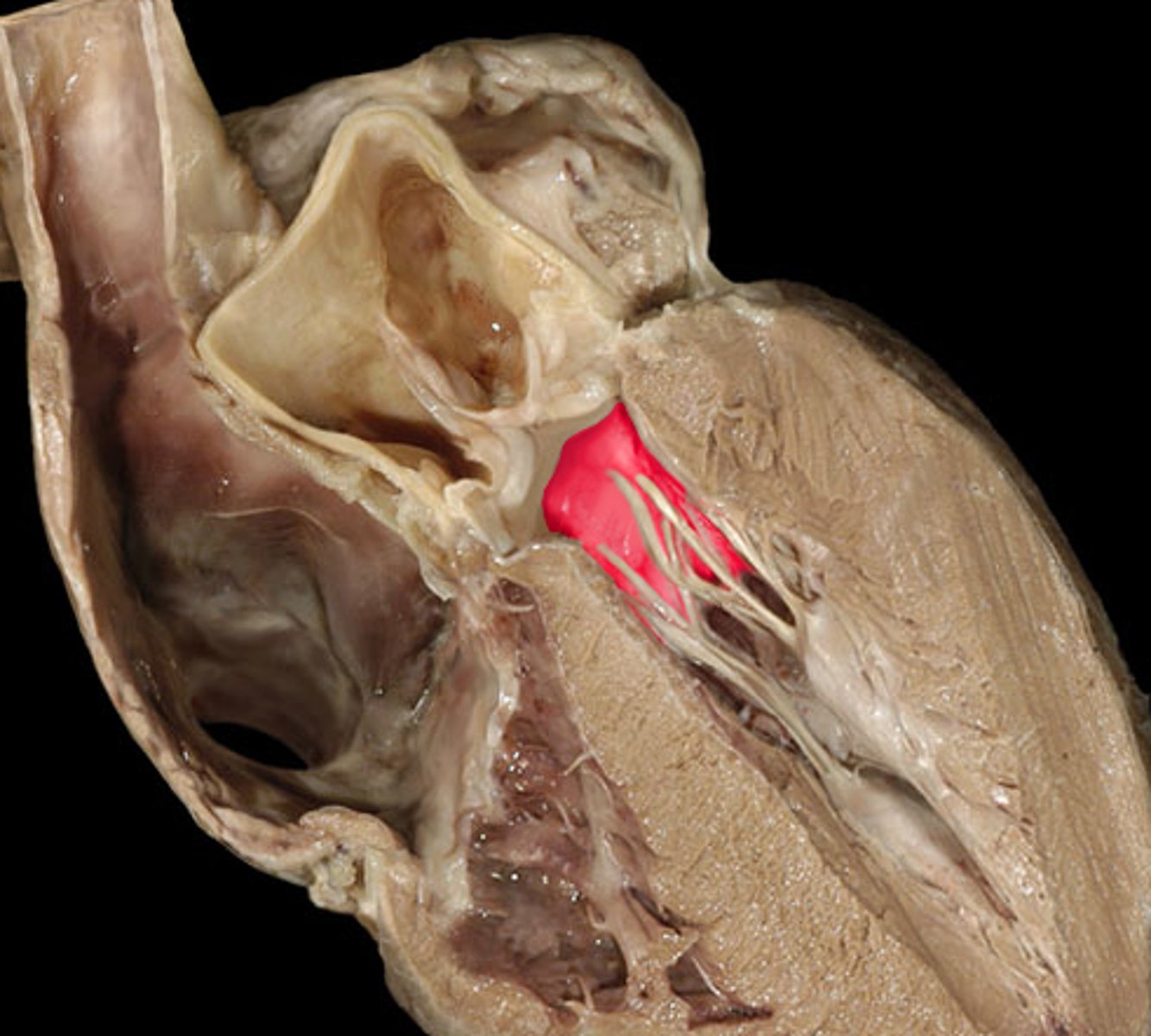 <p>Located between the L atrium and L ventricle</p>