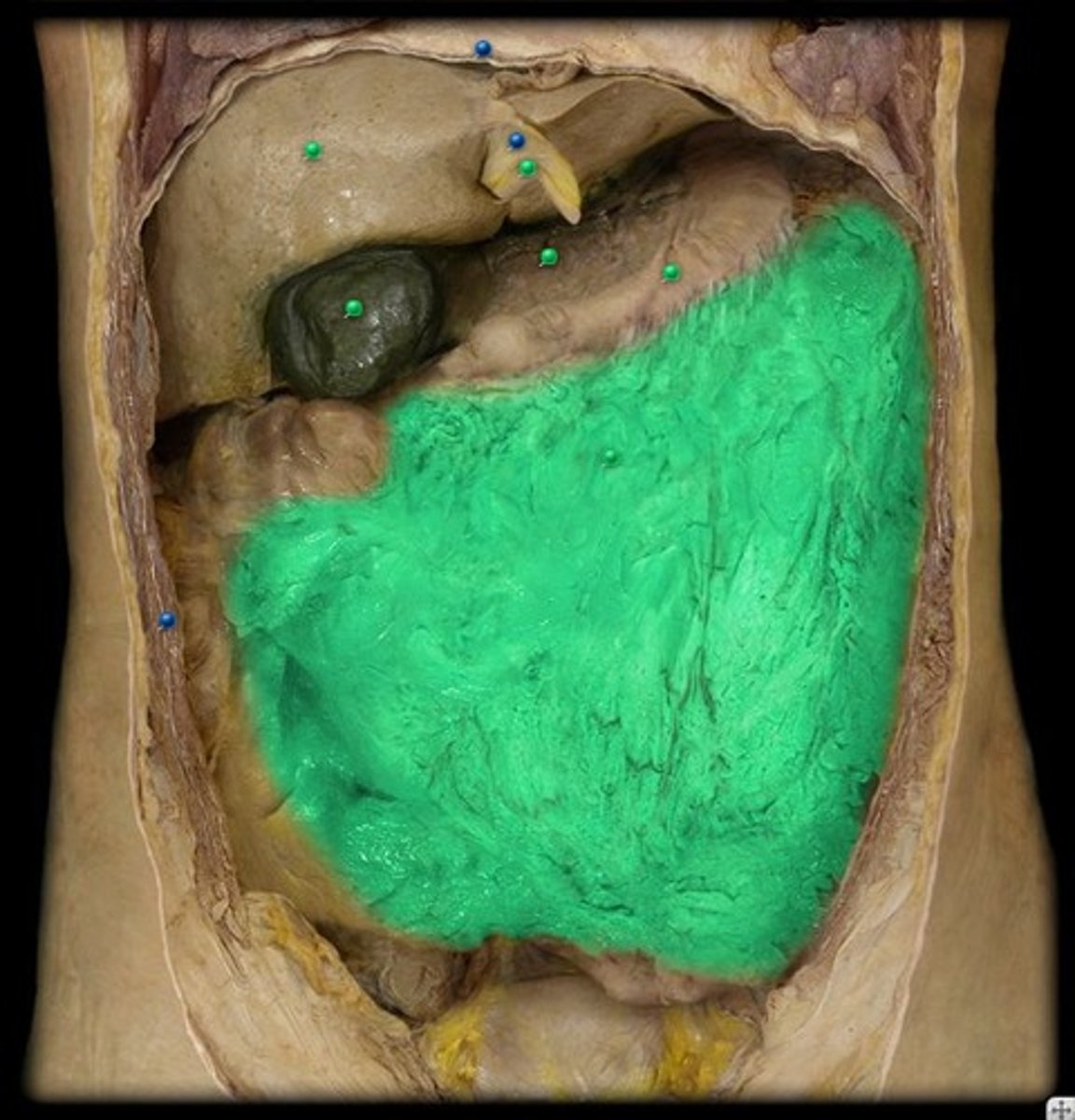 <p>a large apron-like fold of visceral peritoneum that hangs down from the stomach</p>