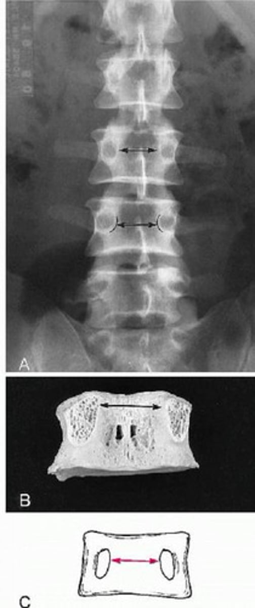 <p>What line of mensuration is this?</p>