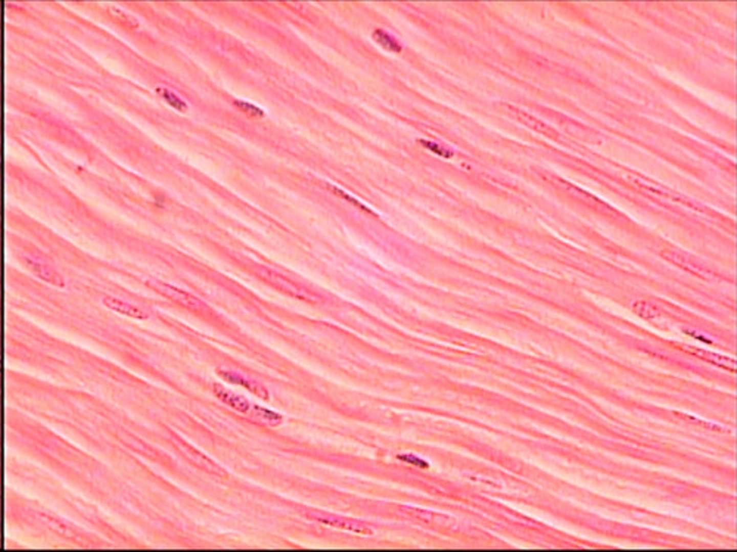 <p>- Non-striated</p><p>- Involuntary</p><p>- "Spindle" shape - tapered ends</p><p>- 1 central nucleus</p><p>- Found around the organs</p>