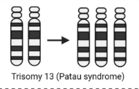 <p><span><span>a condition where an organism has three copies of a specific chromosome instead of the usual two</span></span></p>