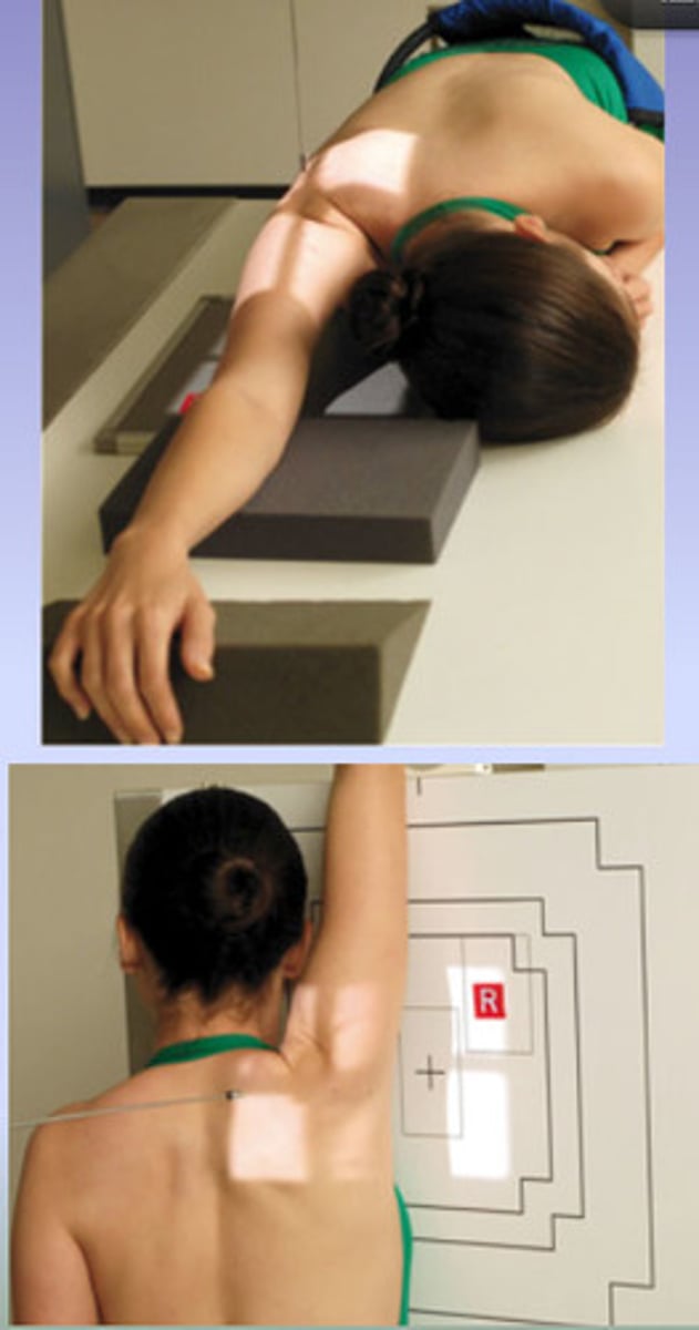 <p>-Patient is erect or leaning over the end of the table with arm of interest raised as high as possible. The patient is positioned in a slight 5 to 10 degree anterior oblique.</p><p>-CR is directed perpendicular to the axilla and the humeral head to pass through the glenohumeral joint.</p>