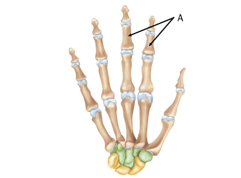 Which bones are indicated by the letter A on the figure?