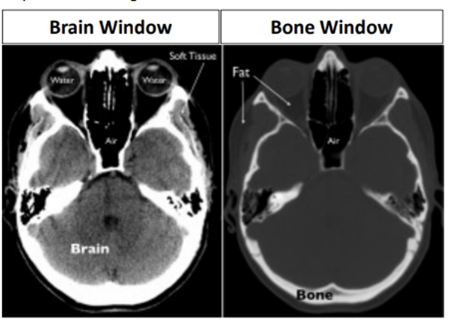 <p>a scan which is a series of X-rays taken at different angles to create cross sectional images. Has the ability to image a wide variety of structures including bone, soft tissues, tumors, vasculature, etc.</p>