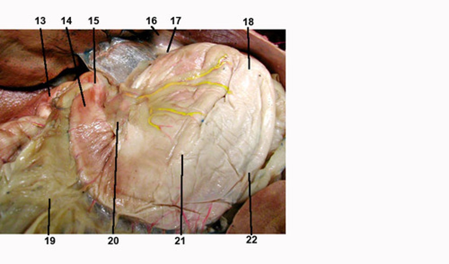 <p>what organ is this?</p>
