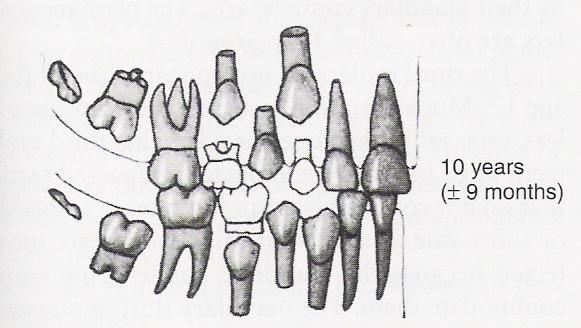 <p>Permanent 1st molars, lateral incisors, central incisors, primary 2nd molars, and primary maxillary canine</p>