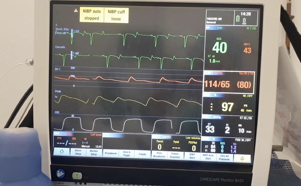 <p>Which species does this ECG most likely represent?</p>