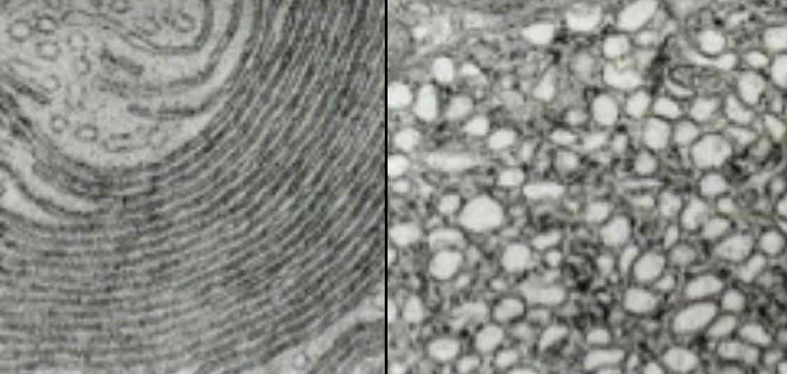 <p>STRUCTURE <br>System/sheets of membranes enclosing a fluid filled space<br>Forms flattened sacs called cisternae. <br>RER covered in ribosomes on surface<br><br>FUNCTION ROUGH ENDOPLASMIC RETICULUM<br>Protein synthesis on the ribosomes <br>Proteins into the lumen of RER and folds into tertiary structure, <br>polypeptide packed into vesicles to travel to golgi apparatus<br><br>FUNCTION SMOOTH ENDOPLASMIC RETICULUM<br>Synthesis and stores lipids and carbohydrates</p>