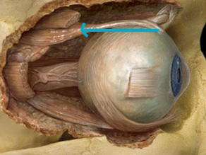 <p>what muscle?</p>