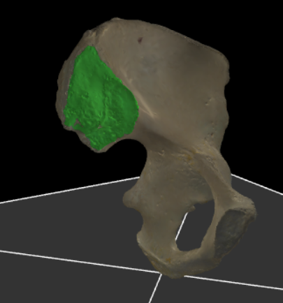 <p>De combinatie van de tuberositas iliaca en facies auricularis, die samen een belangrijk gewrichtsvlak vormen voor de verbinding met het heiligbeen.</p>