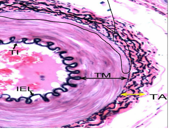 <p>Some arteries have an outer layer of elastic tissue ( the external elastic membrane) which marks the boundayr between the tunica media and the tunica adventitia</p>
