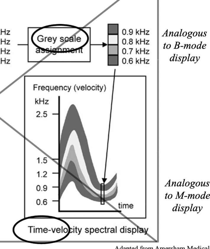 <p><strong>How is a Spectral Doppler Waveform Generated ( using the frequency spectrum and time-velocity spectrum) </strong></p>