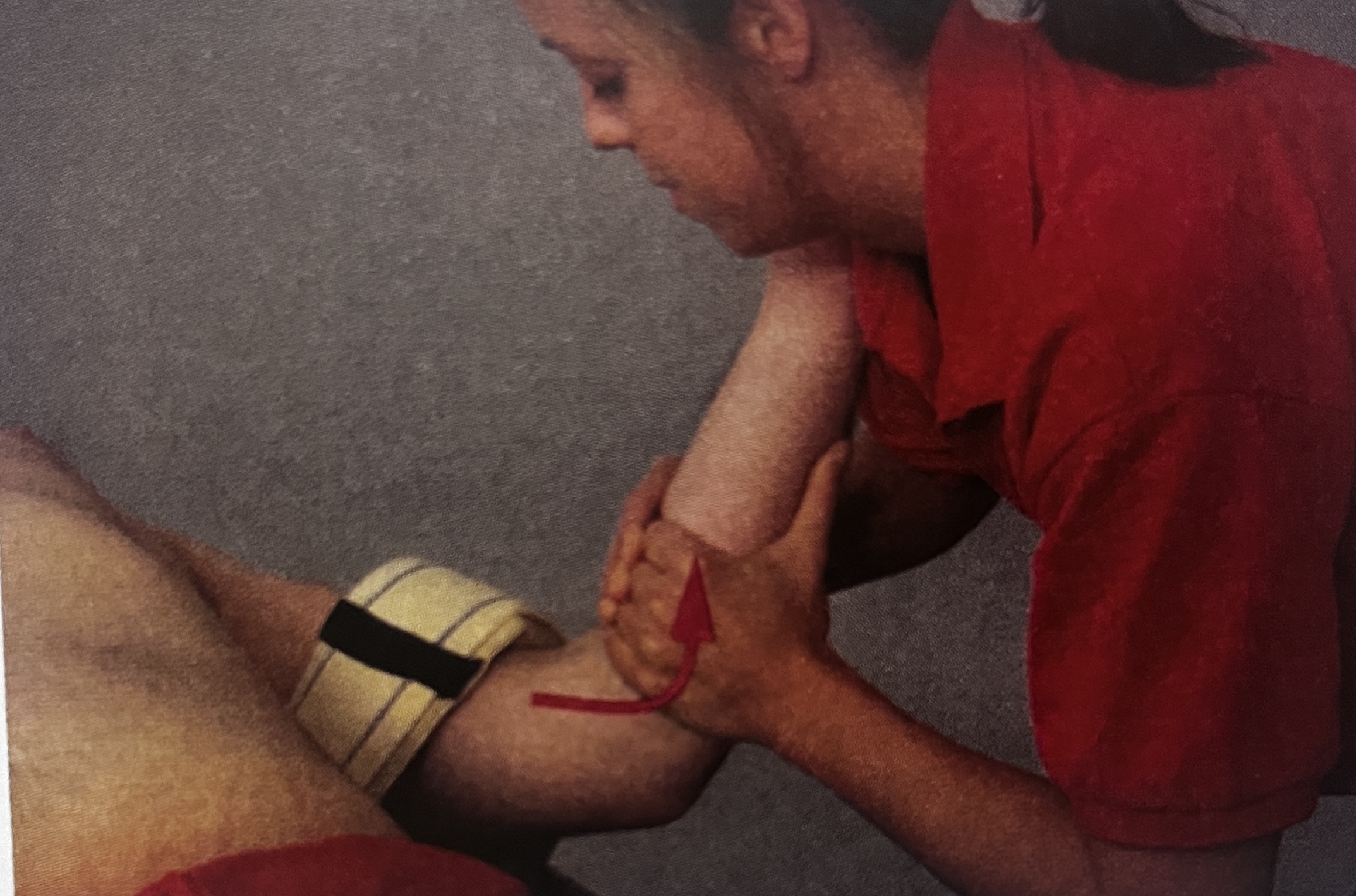 <p>What joint mob is this?</p>