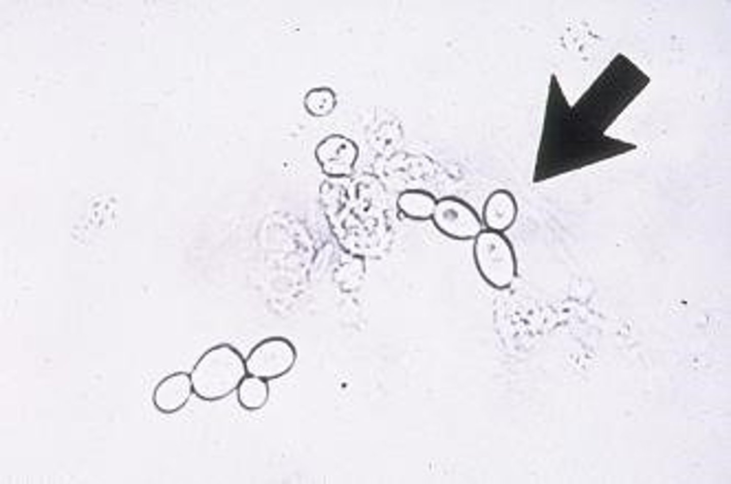 <p>- gram (+)</p><p>- reproduce via budding</p><p>- large, oval-shaped cells</p><p>- nonfilamentous (unicell.)</p><p>- produce pseudohyphae -> forms chain of yeast cells</p><p>- ferments carbs</p>